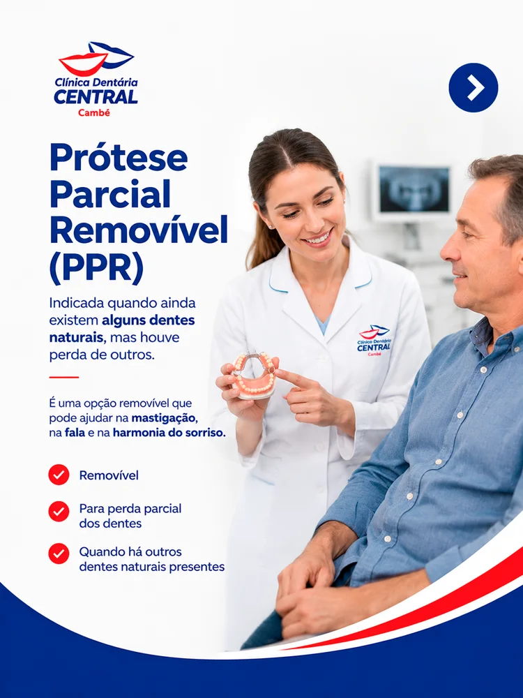 Prótese parcial removível